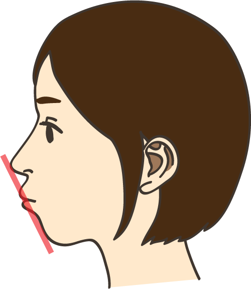 矯正歯科治療 白羽歯科